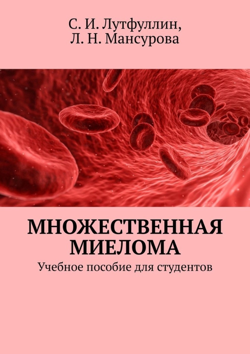 Множественная миелома 2023. Множественная миелома книга. Интерлейкин 6 множественная миелома. Множественная миелома на коже.